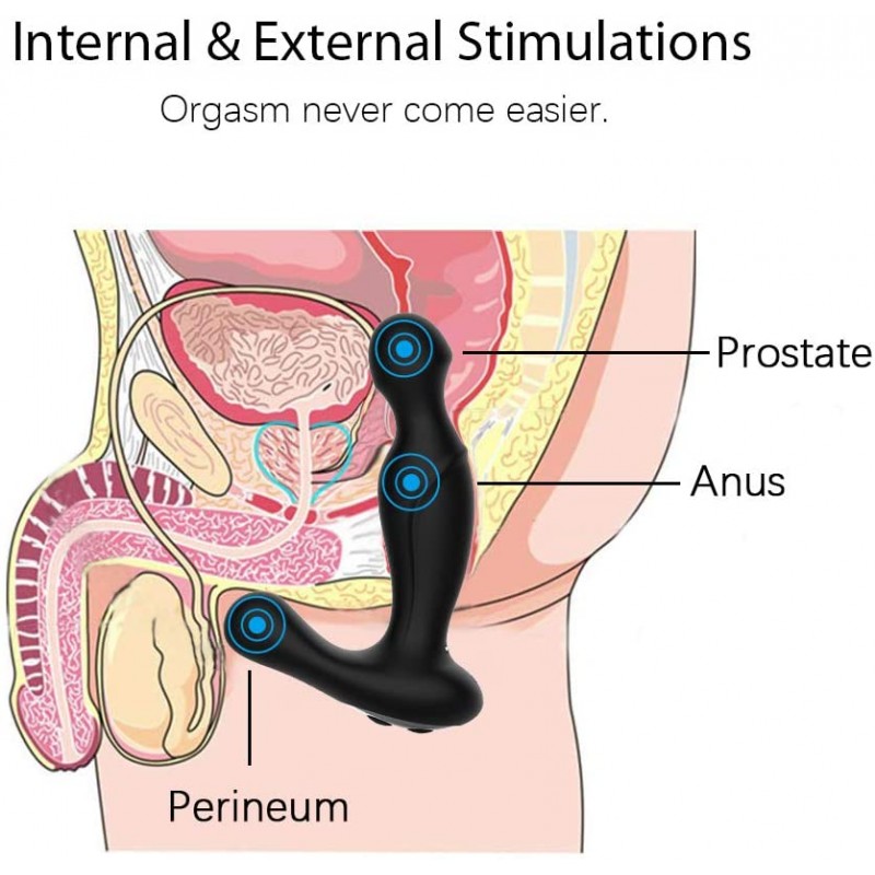 회전 항문 진동기 전립선 마사지-Adorime 무선 질 G-Spot P-spot 음핵 회음 자극기 10 진동 및 5 회전 모드, 남성용 여성 및 커플 용 충전식 성인 섹스 토이