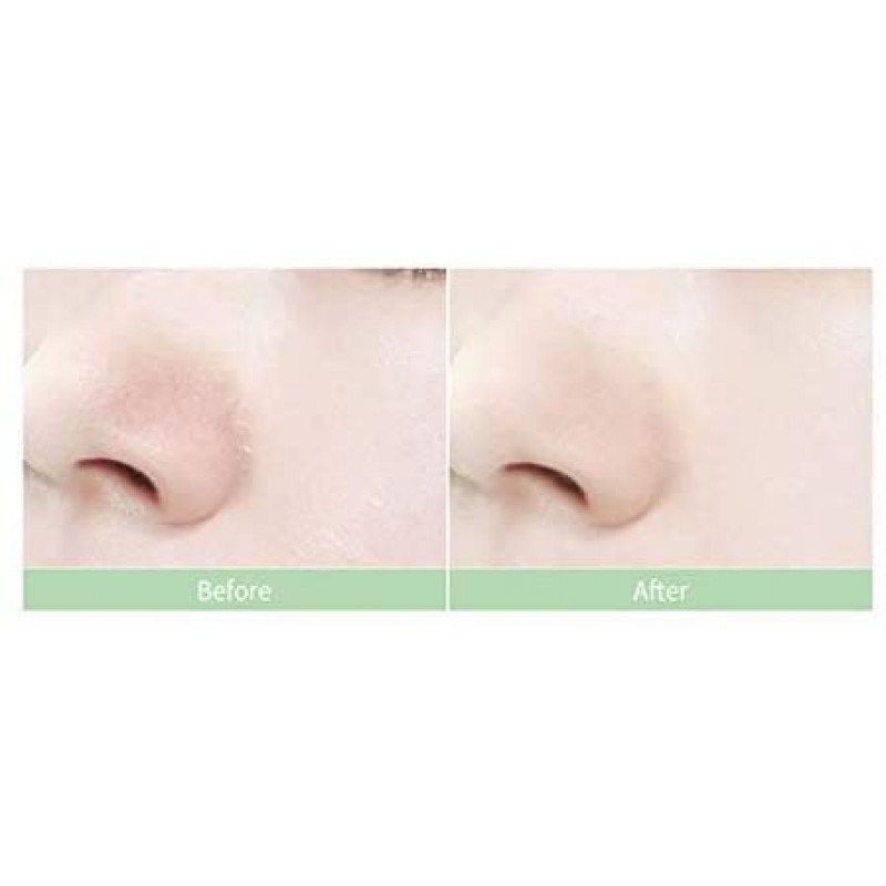 카리 오피 포르 툴라 카 앰플 10ml 1 개