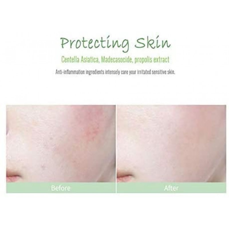 카리 오피 포르 툴라 카 앰플 10ml 1 개