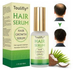 HAIR SERUM - 모발 성장 세럼, 탈모 및 탈모 치료, 탈모 중지, 천연 허벌 에센스, 새로운 모발 성장 촉진 (50ml)