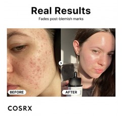 COSRX 나이아신아미드 15% 페이스 세럼, 확대된 모공 최소화, 홍조 완화, 잡티 및 변색 교정 트리트먼트, 0.67 fl.oz/20 ml, 동물 테스트 안 함, 한국 스킨케어