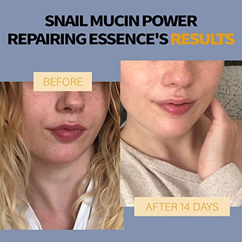 DSKMED 달팽이 뮤신 96% 파워 리페어링 에센스 3.38 fl.oz,100ml, 달팽이 점액 여과물이 함유되어 칙칙하고 손상된 피부를 위한 수분 공급 세럼, 주름 감소, 파라벤 없음, 한국 스킨케어(1PCS)