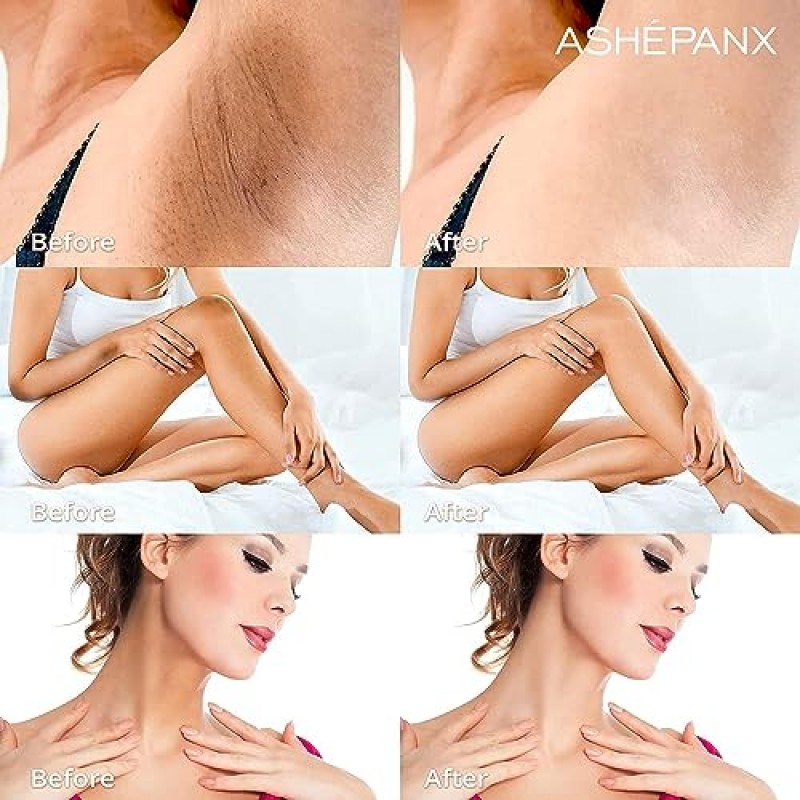 ASHEPANX 다크 스팟 코렉터 크림, 고급 포뮬러가 포함된 친밀한 부위 겨드랑이 크림, 목, 무릎, 팔꿈치, 겨드랑이 및 개인 부위에 즉각적인 보습 효과 제공