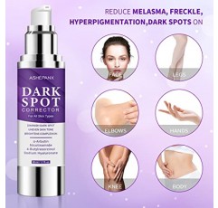 ASHEPANX 다크 스팟 코렉터 크림, 고급 포뮬러가 포함된 친밀한 부위 겨드랑이 크림, 목, 무릎, 팔꿈치, 겨드랑이 및 개인 부위에 즉각적인 보습 효과 제공