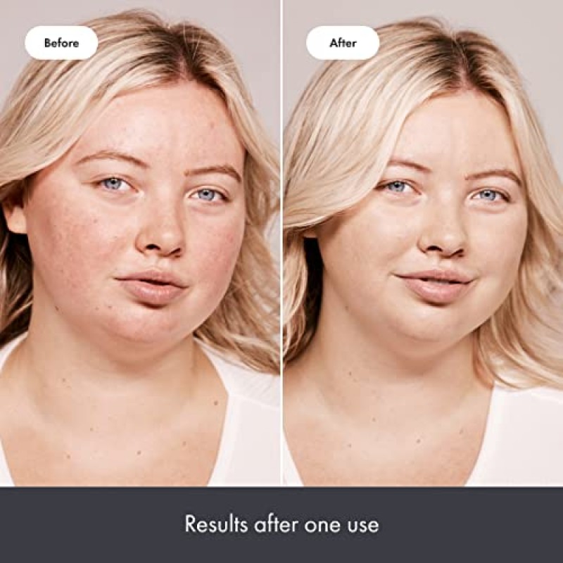 Hero Cosmetics 레스큐 밤 & 레드 코렉트 포스트 블레미쉬 회복 크림 - 영양, 진정, 피부과 테스트 완료, 비건(0.5 fl oz)