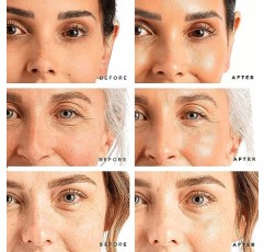 브라이트닝, 퍼밍, 수분 공급을 위한 트리 오브 라이프 비타민 C, 레티놀, 히알루론산 세럼 트리오