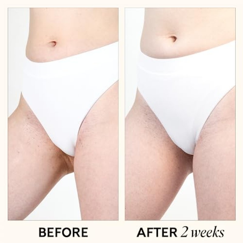 모피 인그로운 제거제 세럼: 제모 후 케어 및 인그로운 헤어 트리트먼트 - 1.1 FL OZ