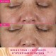 파머시 3% TXA 브라이트닝 토너 포 페이스 - 강력한 다크 스팟 코렉터 & 아젤라산 및 PHA 함유 페이스 토너, 120ml