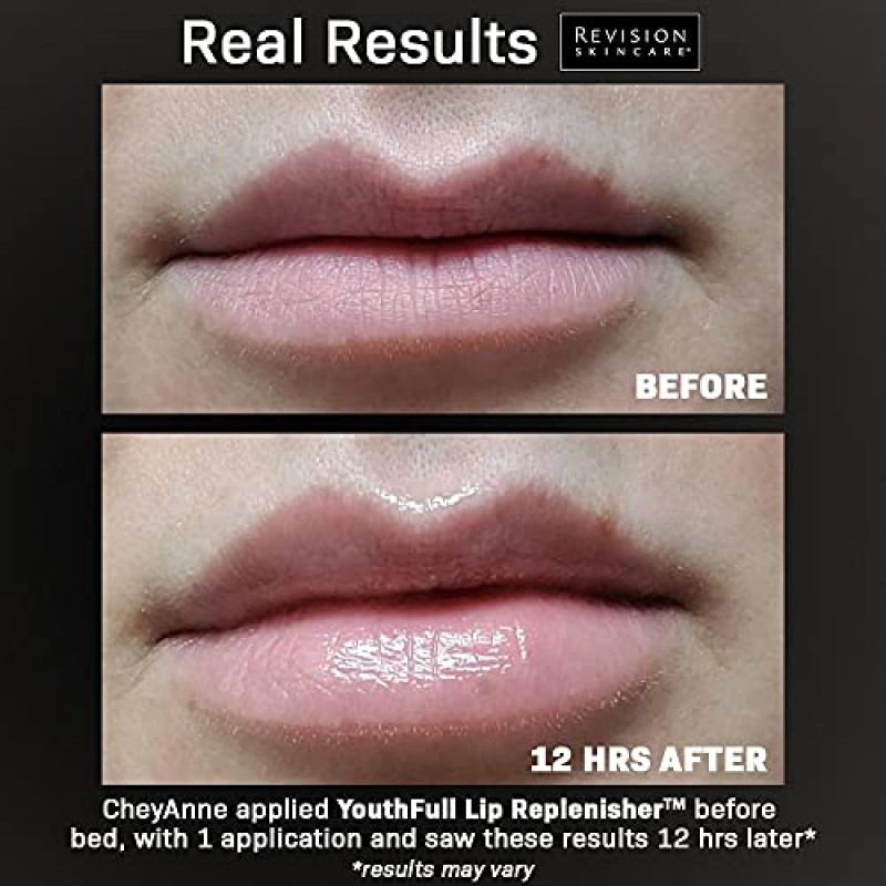 Revision Skincare Youth젊은 입술을 위한 완벽한 솔루션인 히알루론산이 함유된 풀 립 리플레니셔, 눈에 띄게 볼륨을 부여하고 정의하며 수분을 공급하고 진정시킵니다, 0.33온스