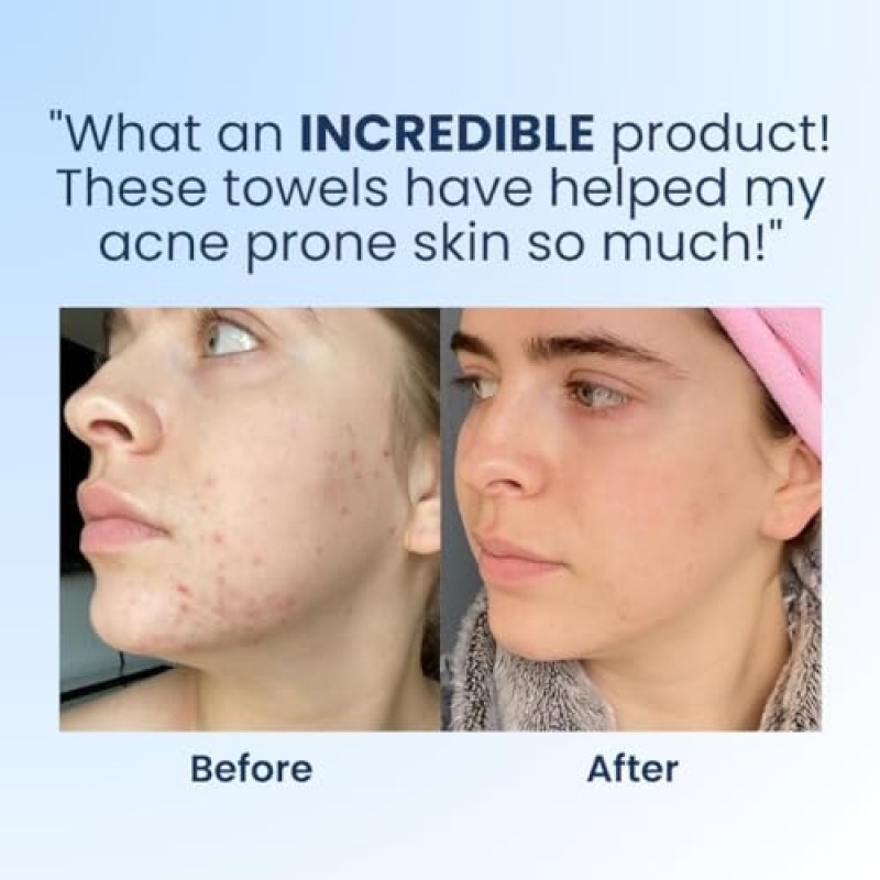 Clean Skin Club 클린 타월 XL 여행용, 3팩 USDA 인증 100% 바이오 기반 피부과 전문의 승인 페이스 타올, 일회용 페이스 타올, 페이셜 수건, 메이크업 리무버 드라이 와이프, 울트라 소프트, 30CT