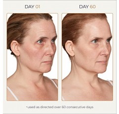 Tru Alchemy 스팟 체크 얼굴용 다크 스팟 리무버 - 나이아신아마이드, 히알루론산, 젖산 및 글리콜산 세럼 - 여성용 에이지 스팟 리무버 - 얼굴용 다크 스팟 코렉터 - 1 fl oz/30 ml