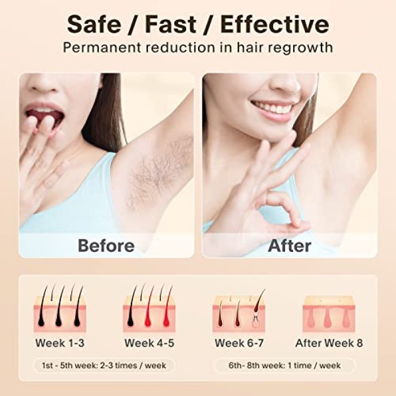 여성을 위한 레이저 제모 영구 IPL 제모 장치 집에서 얼굴 바디를 위한 전문 제모 999,999 영구 플래시로 업그레이드됨