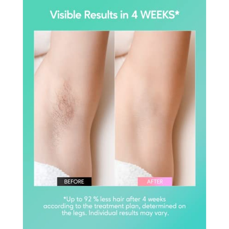 집에서 여성과 남성을 위한 INNZA IPL 제모 장치, 영구 제모 기계, 10 에너지 레벨, 24J 얼굴 비키니 라인 겨드랑이 다리 뒤를 위한 고에너지 제모 핸드셋, 유선