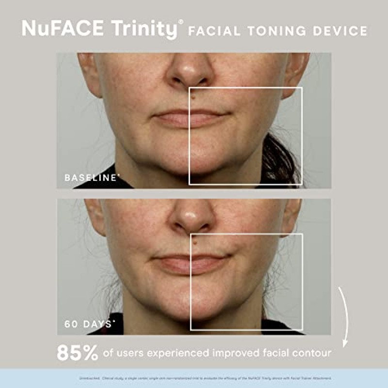 NuFACE 트리니티 스타터 키트. 하이드레이팅 리브 온 젤 프라이머가 포함된 페이셜 토닝 디바이스, 2 Fl Oz