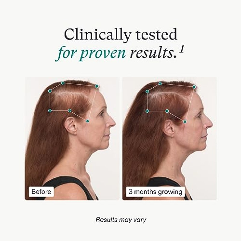 Nutrafol 여성용 밸런스 모발 성장 보조제, 45세 이상, 눈에 띄게 두꺼운 모발과 두피 커버력이 임상적으로 입증됨, 피부과 전문의 권장 - 1개월 분량