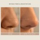 SHANI DARDEN SKINCARE 트리플 애시드 필, 피부 각질 제거 및 모공 개선을 위한 표면 재포장 필, 1.69 fl oz