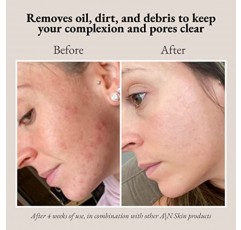 A | N Skin & Beauty 살리실산, 글리콜산, 젖산 함유 엑스폴리에이팅 페이스 패드 - 파라벤 및 황산염 프리 페이스 패드 - 건성, 중성, 지성 및 노화 피부용 글리콜산 패드 - 60개 패드