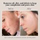 A | N Skin & Beauty 살리실산, 글리콜산, 젖산 함유 엑스폴리에이팅 페이스 패드 - 파라벤 및 황산염 프리 페이스 패드 - 건성, 중성, 지성 및 노화 피부용 글리콜산 패드 - 60개 패드