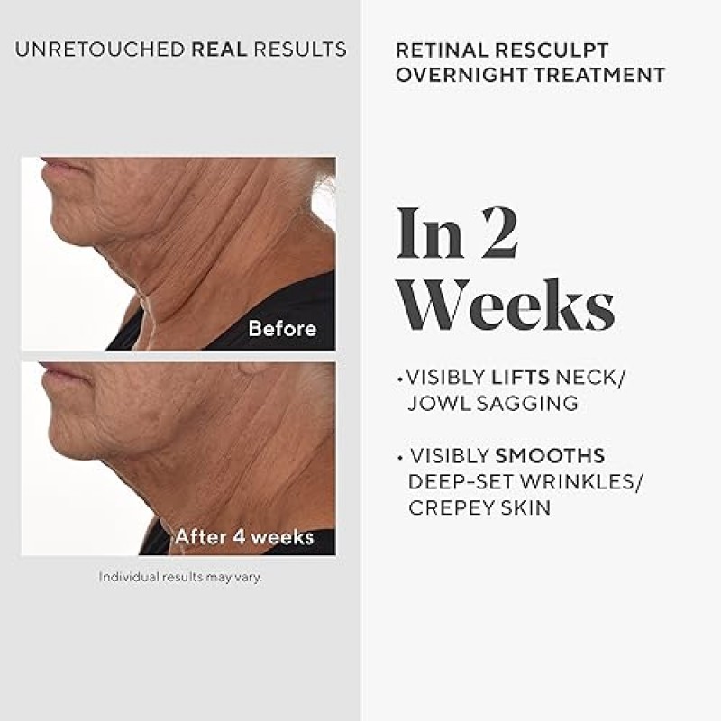 Murad Retinal ReSculpt 오버나이트 트리트먼트 - 주름과 주름을 위한 리서전스 안티 에이징 세럼 - 얼굴과 목을 부드럽게 하고 탄력 있게 하고 리프팅하는 비타민 A 캡슐형 스킨 케어, 1.0 Fl Oz