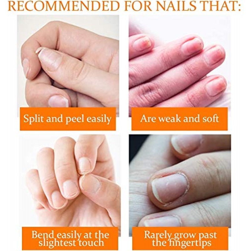 Nail Tek Repairs 손상된 네일 키트. 인텐시브 테라피(.5OZ), 파운데이션(.5OZ) 및 리뉴(.48OZ)