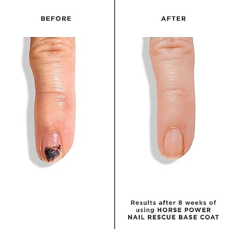 Butter LONDON Horse Power Nail Rescue 베이스코트, 손상된 손톱 복원 및 구조에 도움, 손톱 성장 촉진 및 얼룩 방지에 도움, 잔인함 및 글루텐 없음