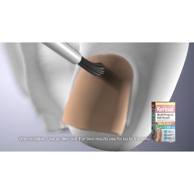 Kerasal 다목적 네일 리페어, 변색되고 손상된 손톱을 위한 네일 솔루션, 0.43 fl oz