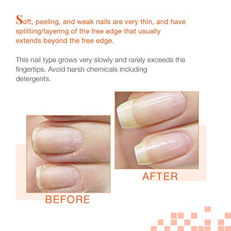 Nail Tek 인텐시브 테라피 2, 부드럽고 벗겨지는 손톱을 위한 손톱 강화제, 0.5oz Value 4팩