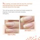 Nail Tek 인텐시브 테라피 2, 부드럽고 벗겨지는 손톱을 위한 손톱 강화제, 0.5oz Value 4팩