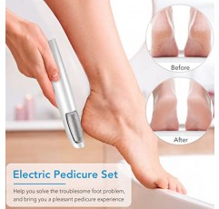 LINKEVAP 발용 전기 굳은살 제거제, 건조하고 죽은 피부, 갈라진 피부, 딱딱한 피부용 전문 페디큐어 키트 발 스크러버, 남성 및 여성을 위한 가정용 발 스파 케어 키트(차가운 흰색)