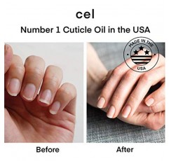 cel MD 큐티클 오일 펜 네일 강화제 리페어 세럼 – 손상된 손톱을 위한 네일 리페어 – 갈라진 손톱과 단단하고 건조한 큐티클을 복구하고 영양을 공급합니다 - 2개 세트
