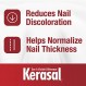 변색되고 손상된 손톱을 위한 티트리 오일 함유 Kerasal Renewal 네일 리페어 솔루션, 0.33온스(1팩)