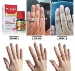 Mavala Scientifique 오리지널 네일 경화제 | 손톱 강화, 손톱 끝 강화, 파손, 벗겨짐 및 벗겨짐 방지, 손톱 수분 회복 | 0.16온스