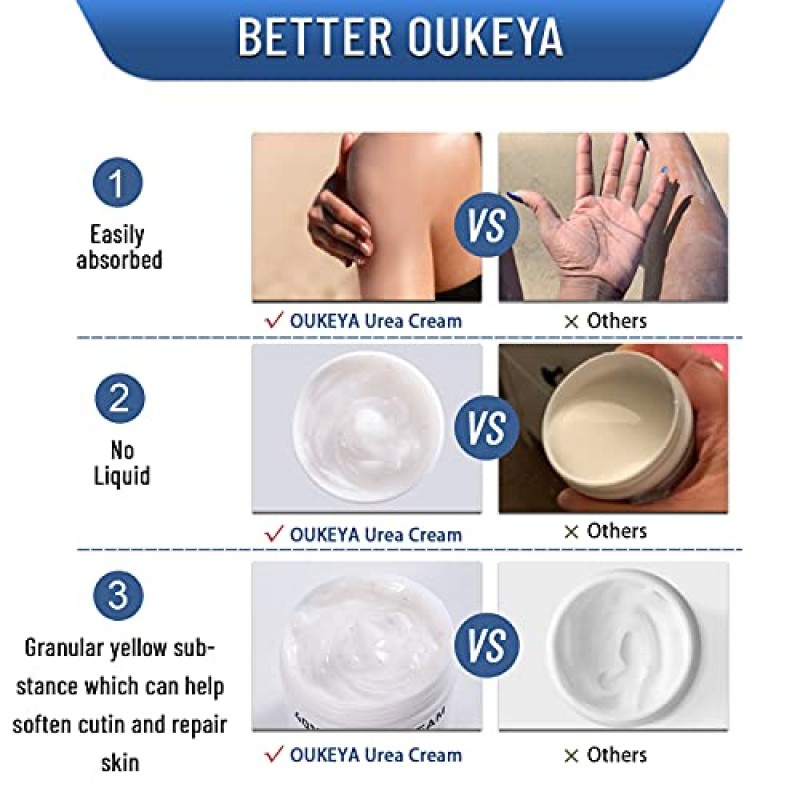 OUKEYA 우레아 크림 40%, 건조 갈라짐용 우레아 풋 크림, 40개 우레아 발 최대 강도용 로션
