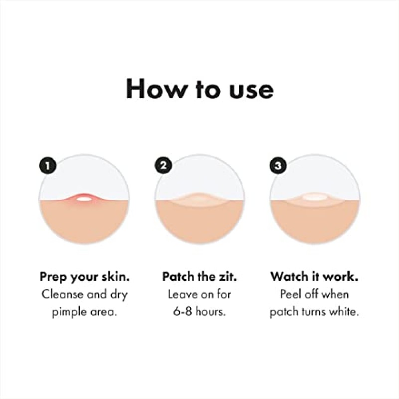 Hero Cosmetics의 Mighty Patch™ 오리지널 패치 - 여드름과 잡티를 덮는 하이드로콜로이드 여드름 여드름 패치, 얼굴과 피부용 스팟 스티커, 채식주의자 친화적이며 동물 테스트를 거치지 않음(36개)