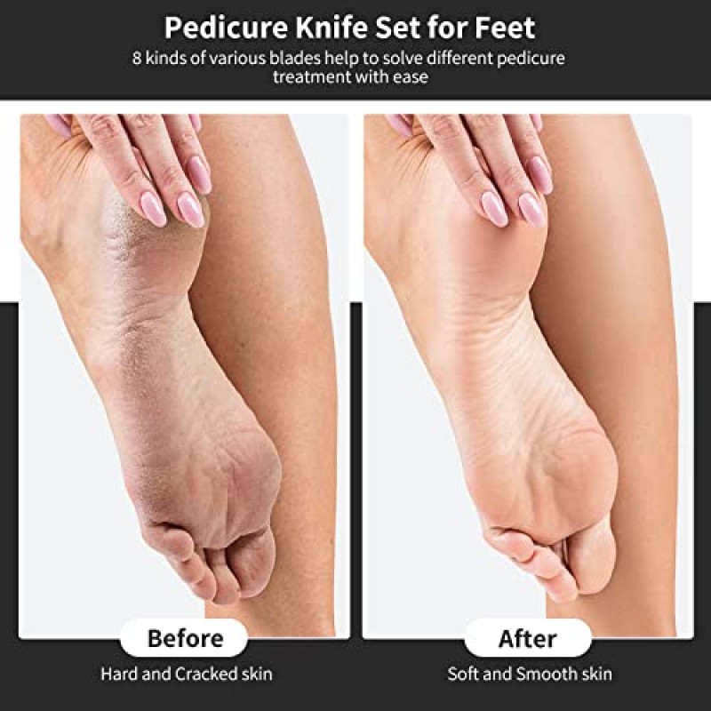 PATURI 페디큐어 나이프 키트, 8pcs 검은 발 죽은 굳은 살 제거제 스테인레스 세트, 전문 자란 발톱 강철 도구, 발 스킨 케어 네일 파일 도구 매니큐어 클리퍼 큐티클 스크레이퍼 발가락 면도기