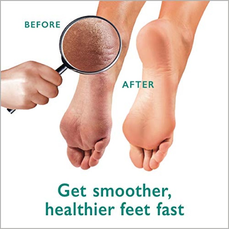 굳은살 제거 젤 + 발 스크러버 키트 - 건조하고 갈라진 발뒤꿈치를 위한 페디큐어 도구