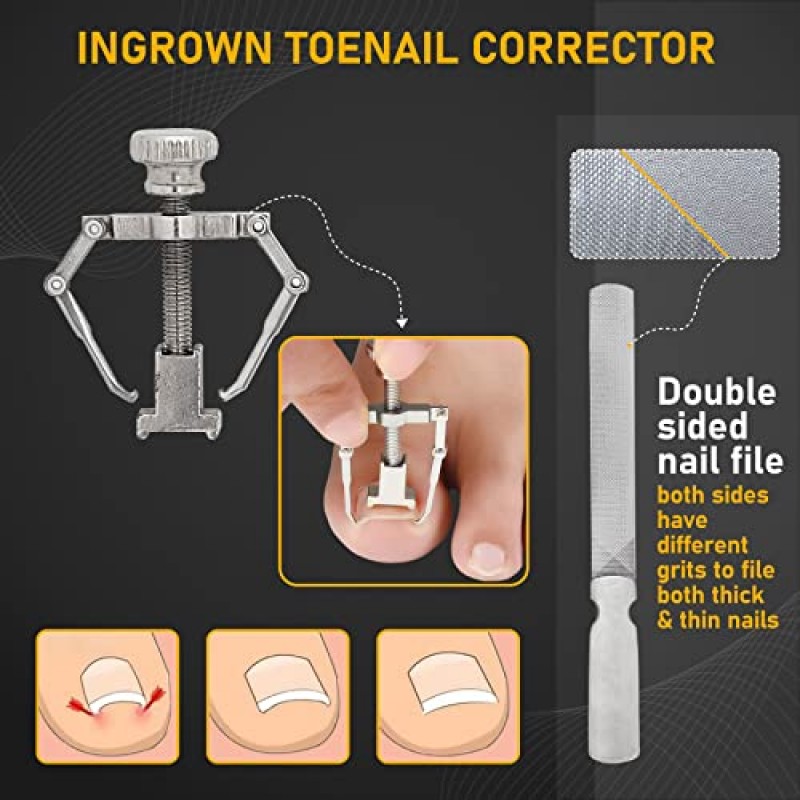 노인을 위한 자란 발톱깎이 8개 두꺼운 발톱 - 남성, 전문가 및 성인을 위한 헤비 듀티 발병 전문의 발가락 손톱 커터 - 쉬운 그립 핸들 스테인레스 스틸 날카로운 곡선 페디큐어 키트 코브 탈출