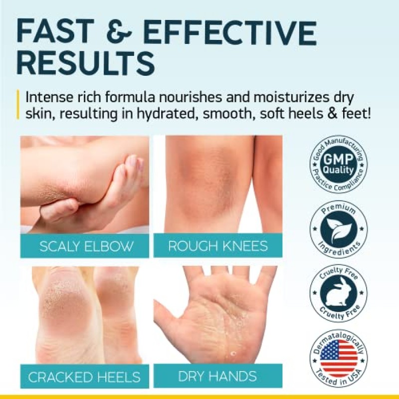 NUVADERMIS 우레아 크림 40% 발용 - 40% 우레아 발 수리 로션 - 건조하고 갈라진 발뒤꿈치를 위한 최대 강도 - 2% 살리실산, 시어 버터, 티트리 오일, 비타민 E - 5.29온스 병