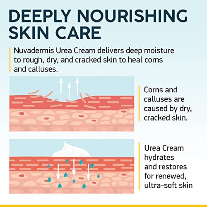 NUVADERMIS 우레아 크림 40% 발용 - 40% 우레아 발 수리 로션 - 건조하고 갈라진 발뒤꿈치를 위한 최대 강도 - 2% 살리실산, 시어 버터, 티트리 오일, 비타민 E - 5.29온스 병
