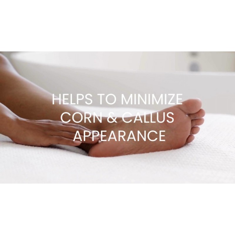 NUVADERMIS 우레아 크림 40% 발용 - 40% 우레아 발 수리 로션 - 건조하고 갈라진 발뒤꿈치를 위한 최대 강도 - 2% 살리실산, 시어 버터, 티트리 오일, 비타민 E - 5.29온스 병