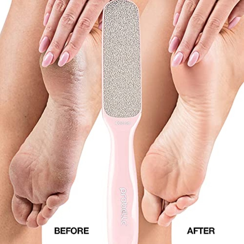 Probelle 양면 다방향 니켈 풋 파일 캘러스 리무버 - 즉각적인 결과를 위해 굳은살과 티눈을 즉시 파우더로 줄여주는 안전한 도구(핑크색)