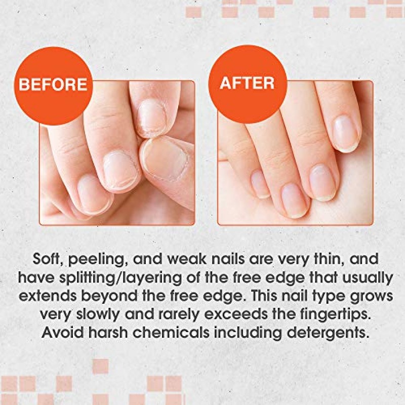 Nail Tek 인텐시브 테라피 2 - 약하고 얇고 부드러우며 벗겨지는 손톱용, 단백질 포뮬러 함유, 손톱 강화, 두꺼워짐, 힘과 유연성 촉진, 0.5온스 - 1팩