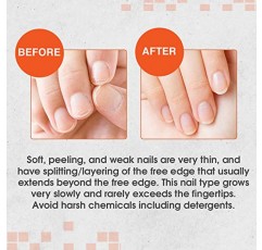 Nail Tek 인텐시브 테라피 2 - 약하고 얇고 부드러우며 벗겨지는 손톱용, 단백질 포뮬러 함유, 손톱 강화, 두꺼워짐, 힘과 유연성 촉진, 0.5온스 - 1팩