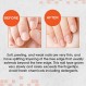 Nail Tek 인텐시브 테라피 2 - 약하고 얇고 부드러우며 벗겨지는 손톱용, 단백질 포뮬러 함유, 손톱 강화, 두꺼워짐, 힘과 유연성 촉진, 0.5온스 - 1팩