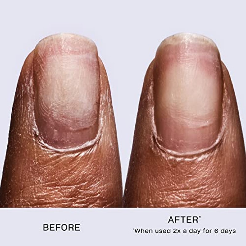 OPI 리페어 모드 본드 빌딩 네일 세럼, 케라틴 단백질, 6일 안에 손톱 복구, 비건 포뮬러, 투명, 0.3 fl oz