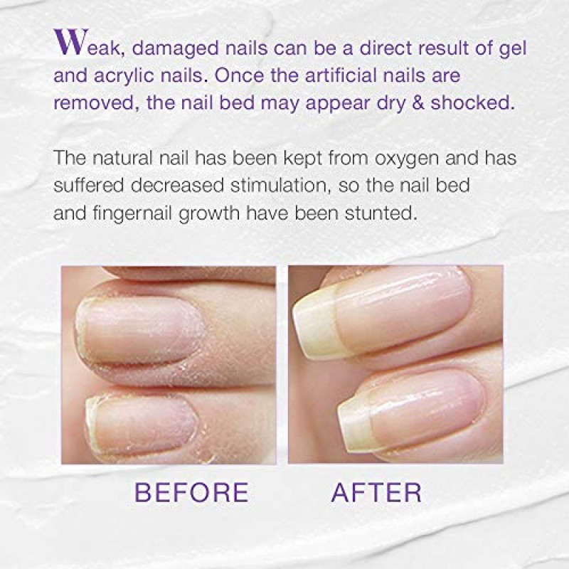 Nail Tek Xtra 4, 약하고 손상된 손톱을 위한 손톱 강화제, 0.5oz, 2팩