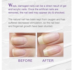 Nail Tek Xtra 4, 약하고 손상된 손톱을 위한 손톱 강화제, 0.5oz, 2팩