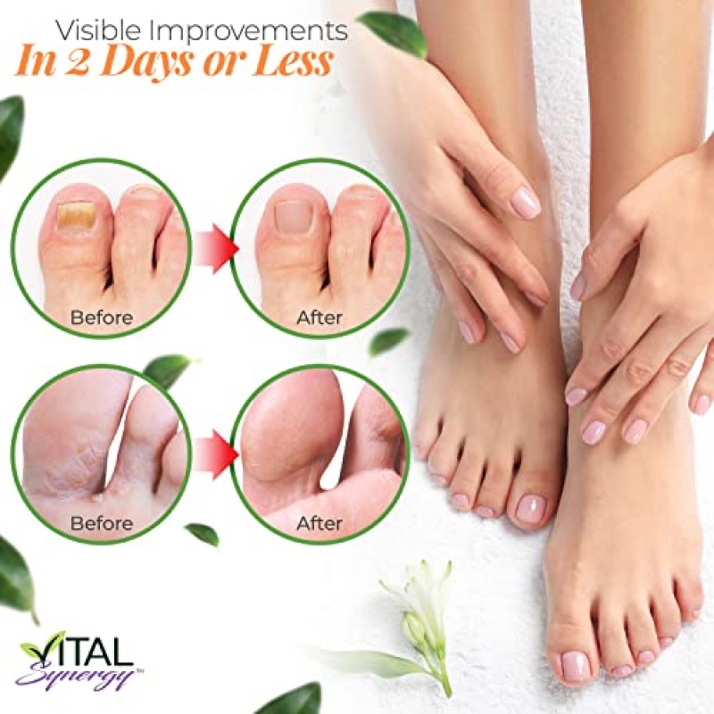 Vital Synergy Natural Tea Tree Oil 발톱 네일 리페어 솔루션 - 발톱 및 손톱 네일 리페어를 위한 네일 트리트먼트 - 무좀 트리트먼트 - 엑스트라 스트렝스 손상된 손톱 발톱 네일 성장 트리트먼트