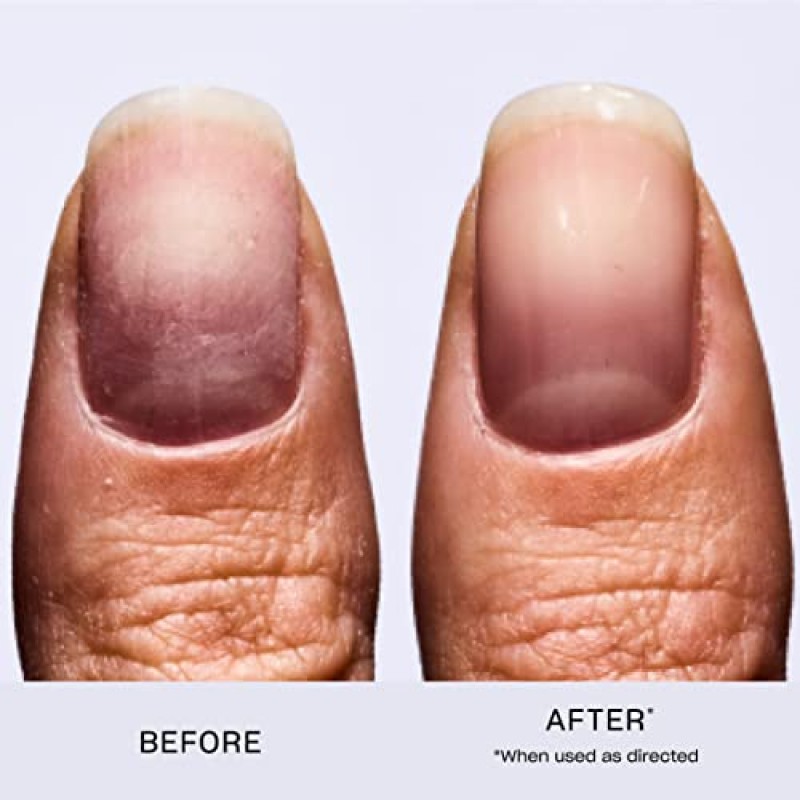 OPI Nail Envy, 손톱 강화 트리트먼트, 1주 안에 손톱 강화, 비건 포뮬러, 0.5 fl oz