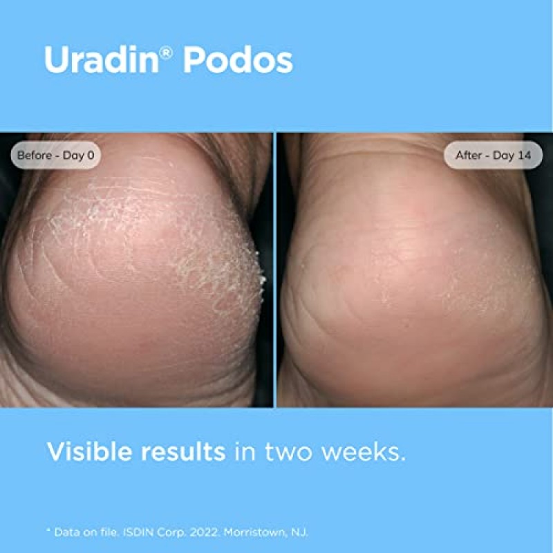 ISDIN 풋 케어 크림, Uradin Podos 젤 오일, 건조하고 갈라진 발을 수리하고 수분을 공급합니다. 요소 10%, 빠른 흡수, 피부과 테스트 완료, 2.5 Fl Oz
